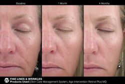 JAN MARINI AGE INTERVENTION RETINOL PLUS MD 1% Крем-акселератор с ретинолом 1% для борьбы с видимыми возрастными изменениями