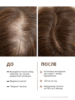 Сыворотка GROW IT от выпадения и для роста волос