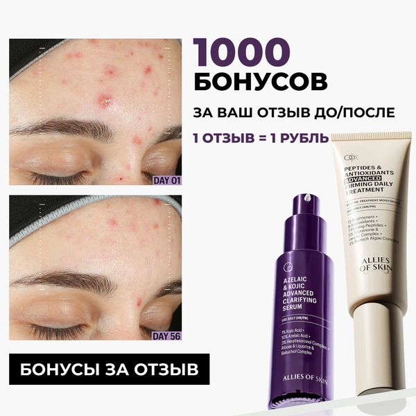 Дарим 1000 бонусов за ваш отзыв ДО/ПОСЛЕ
