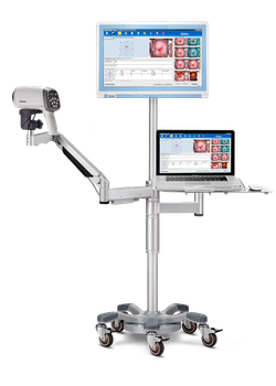 Видеокольпоскоп Edan C6 и Edan C6A