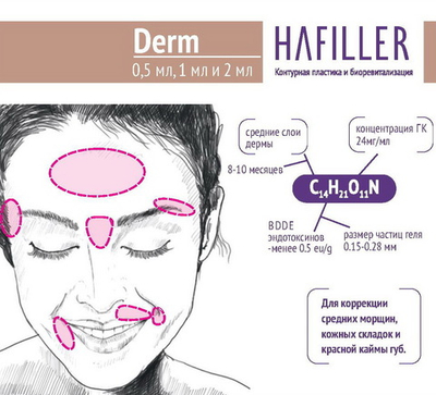 HaFiller Derm | 24 мг/мл | Филлер средний