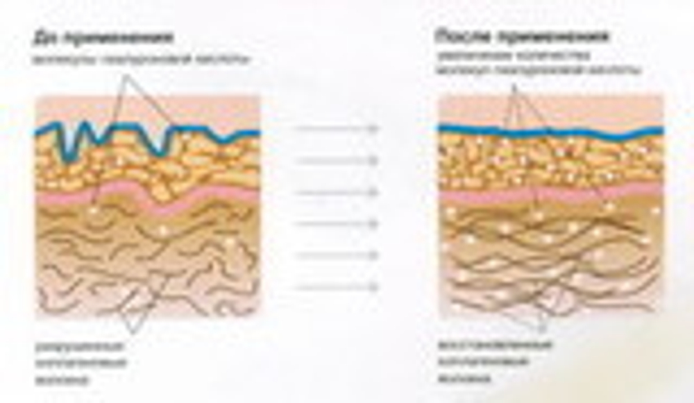 Коллаген рыбий (MegaProtein ST)