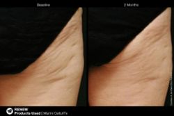 Jan Marini MARINI CELLULITX Высокоэффективный антицеллюлитный крем.  Объем: 114 мл