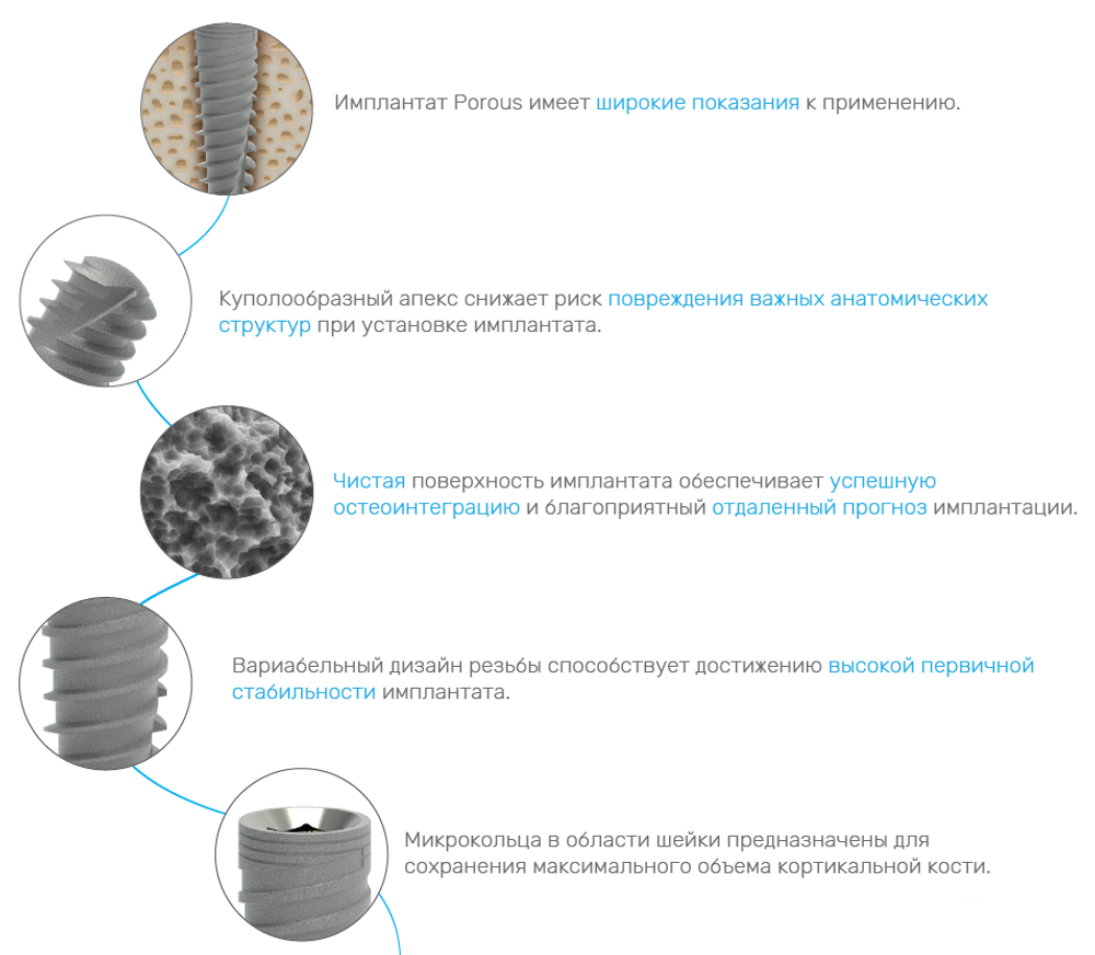 Имплантат Alfa Gate DFCI Porous (D 3.75 мм, L 16 мм)