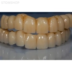 G5 - комбинированный 5-ти осевой станок для влажной обработки | Dental Machine (Италия)