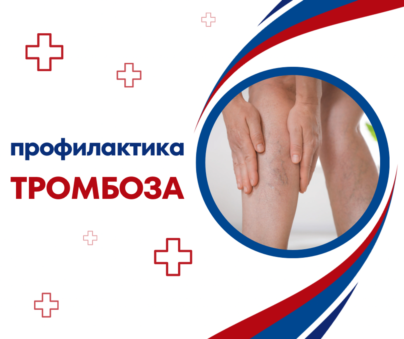 Компрессионный трикотаж и профилактика тромбоза после длительной неподвижности