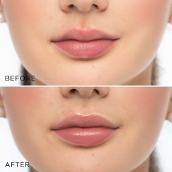 ARTDECO Glossy Lip Volumizer - Блеск для объема губ, 6 ml