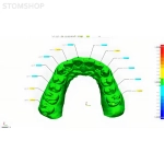 Aoralscan 3 - интраоральный сканер | Shining 3D (Китай)