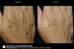 JAN MARINI RETINOL PLUS MASK Высококонцентрированная маска с ретинолом 1%