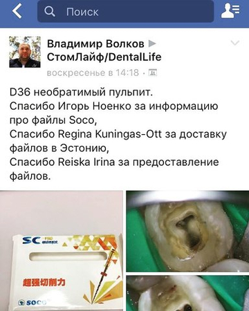 Небольшой отзыв про файлы SOCO.