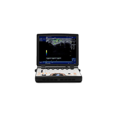 Портативная ультразвуковая система GE Healthcare LOGIQ E