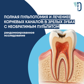 Полная пульпотомия и лечение корневых каналов в зрелых зубах с необратимым пульпитом: рандомизированное исследование