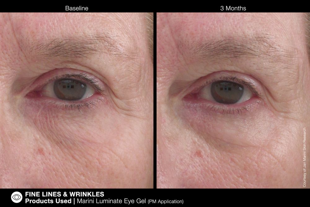 JAN MARINI LUMINATE EYE GEL Концентрированная сыворотка для кожи вокруг глаз с эффектом сияния против темных кругов и морщин