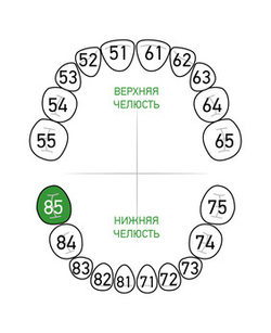 Зона применения клампа для коффердама/раббердама №85 для молочных зубов KSK Dentech (Япония)