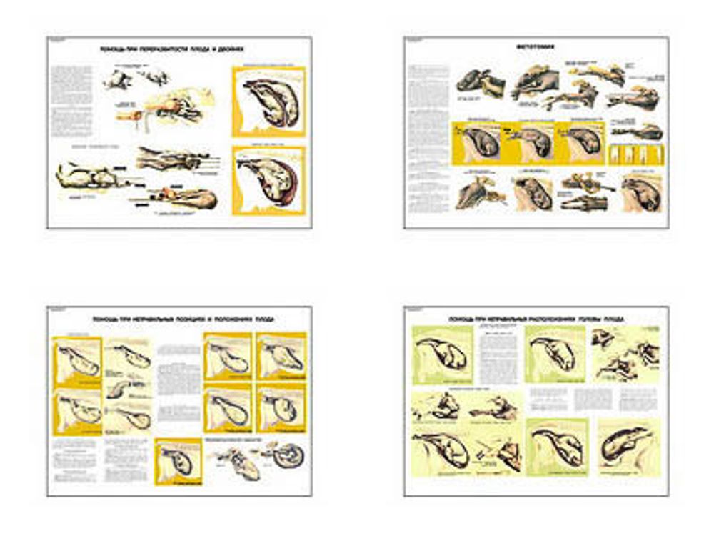 Плакаты ПРОФТЕХ &quot;Акушерская помощь коровам при патологических отелах&quot; (4 пл, винил, 70х100)