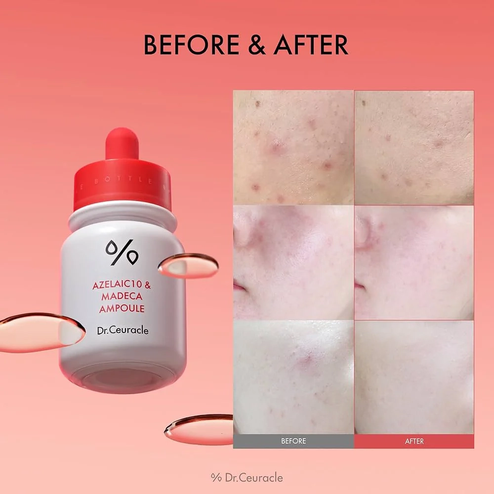 Dr.Ceuracle Azelaic 10 & Madeca Ampoule 30ml