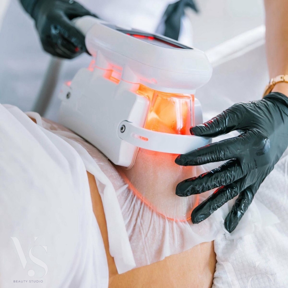 Криолиполиз + EMSculpt 2ч