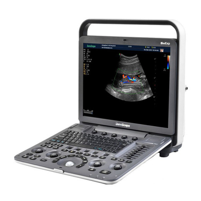 Ультразвуковой аппарат SonoScape S8Exp
