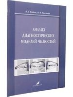 Анализ диагностических моделей челюстей