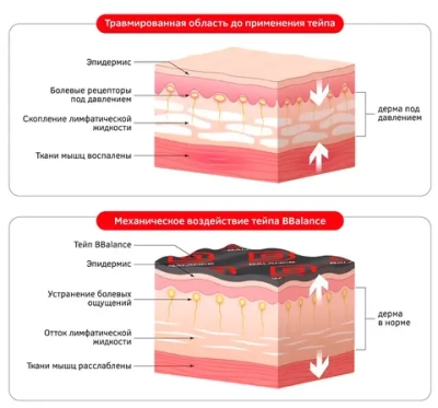 Кинезио тейп BB LYMPH TAPE 5 см х 32 м бежевый