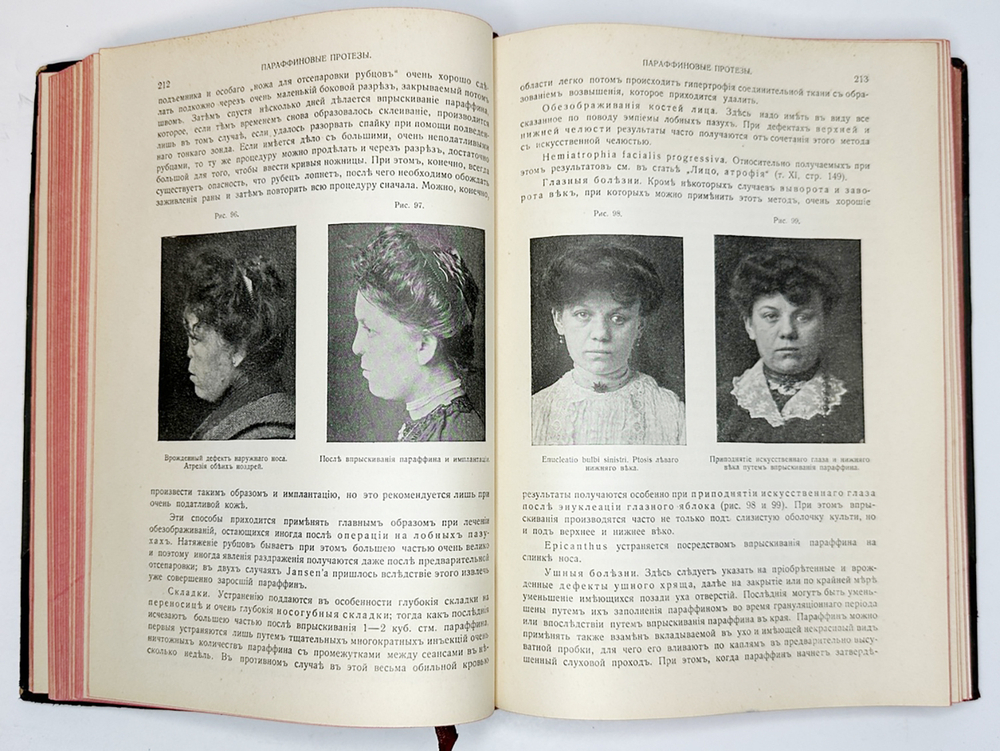 Eulenburg A., проф. Эйленбург А  Реальная энциклопедия практической медицины в XVII томах. 1909-1915