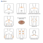 Точечный тейп PHITEN METAX TAPE (300 шт/уп)