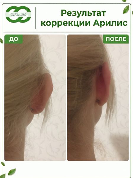 «Я как будто заново родилась!»
