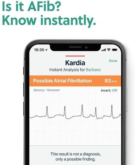 Аппарат ЭКГ AliveCor