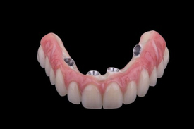 И вновь выручает каркас из ПИИКА