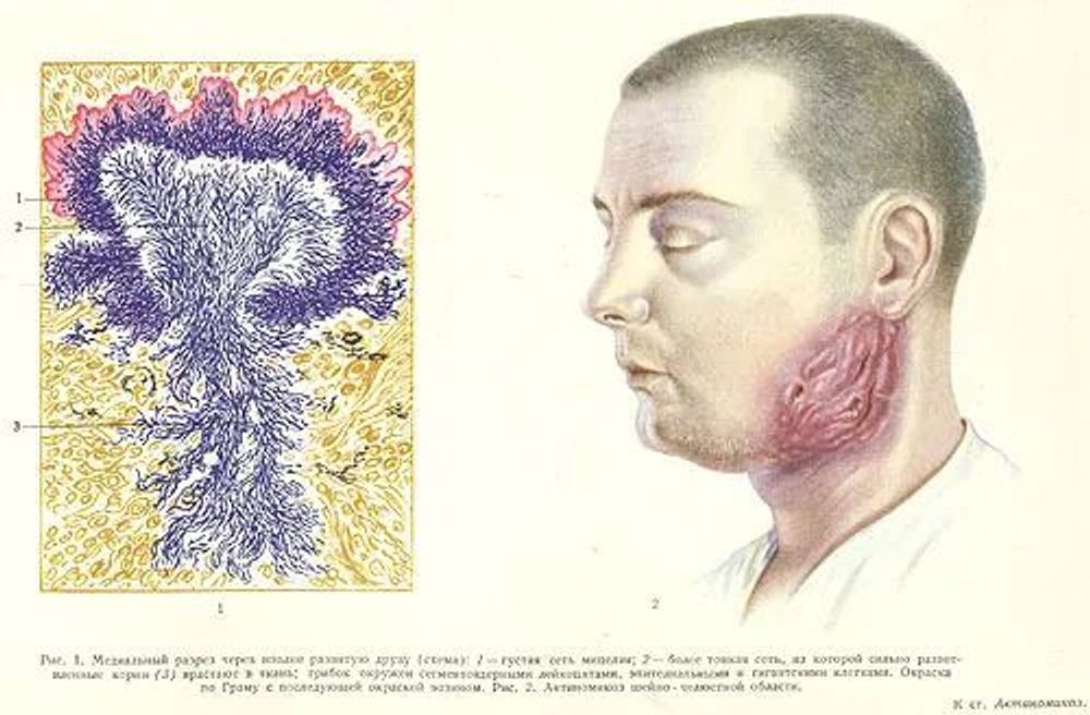 Большая медицинская энциклопедия. В 35-ти томах + дополнительный том (комплект из 36-ти книг)