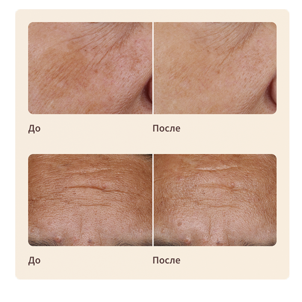 Artistry LongXevity™ Восстанавливающий тонер-сыворотка