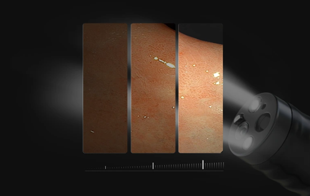 Видеоэндоскопическая система Aohua AQ-110