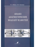 Анализ диагностических моделей челюстей