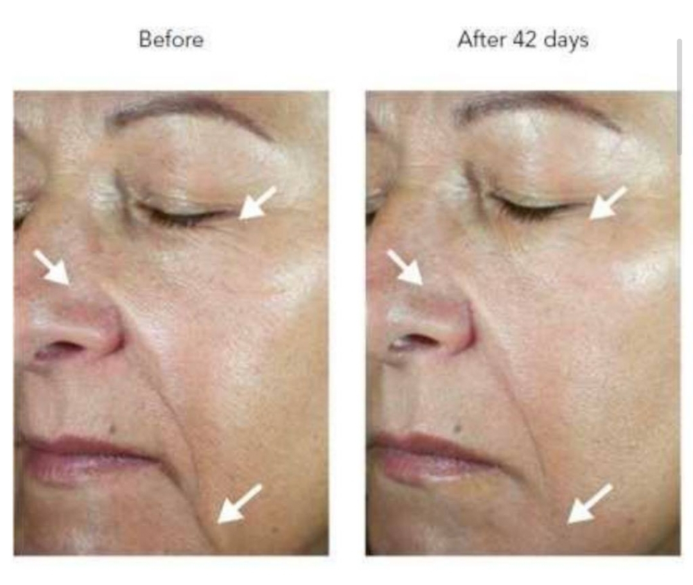 Новинка ! BIJOU DE MER DDS RD Capsule - капсульная омолаживающая эссенция, 30 шт.