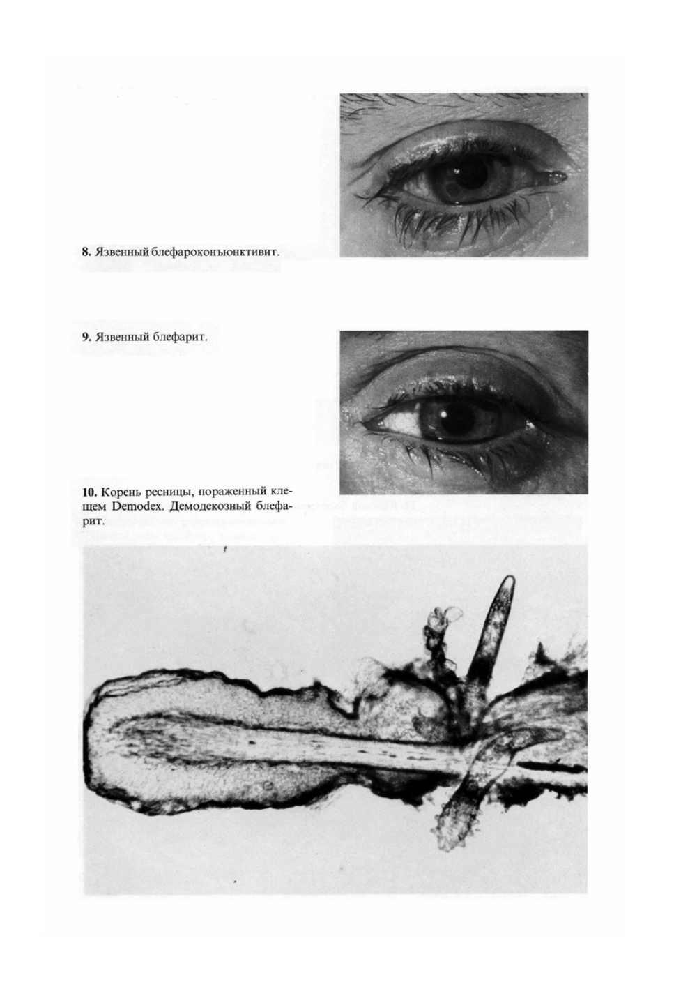 Атлас глазных болезней | Н.А. Пучковская