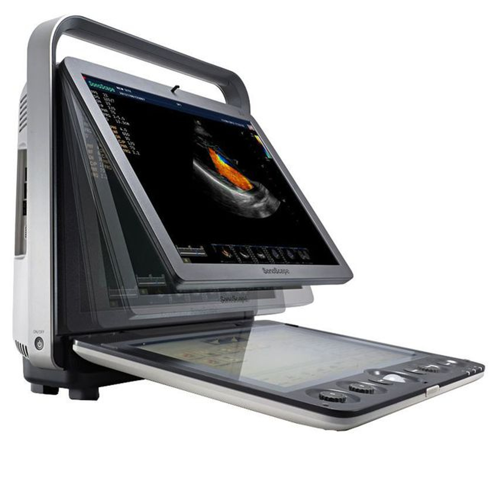 УЗИ аппарат SonoScape S9