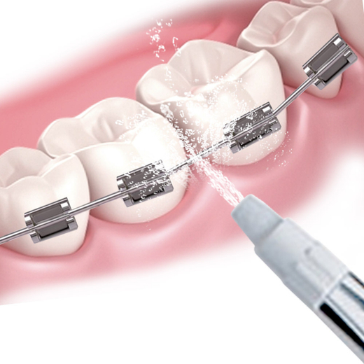 Ортодонтальная насадка GoFlow (1 шт.)