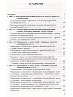 Врождённые пороки развития костей голени у детей