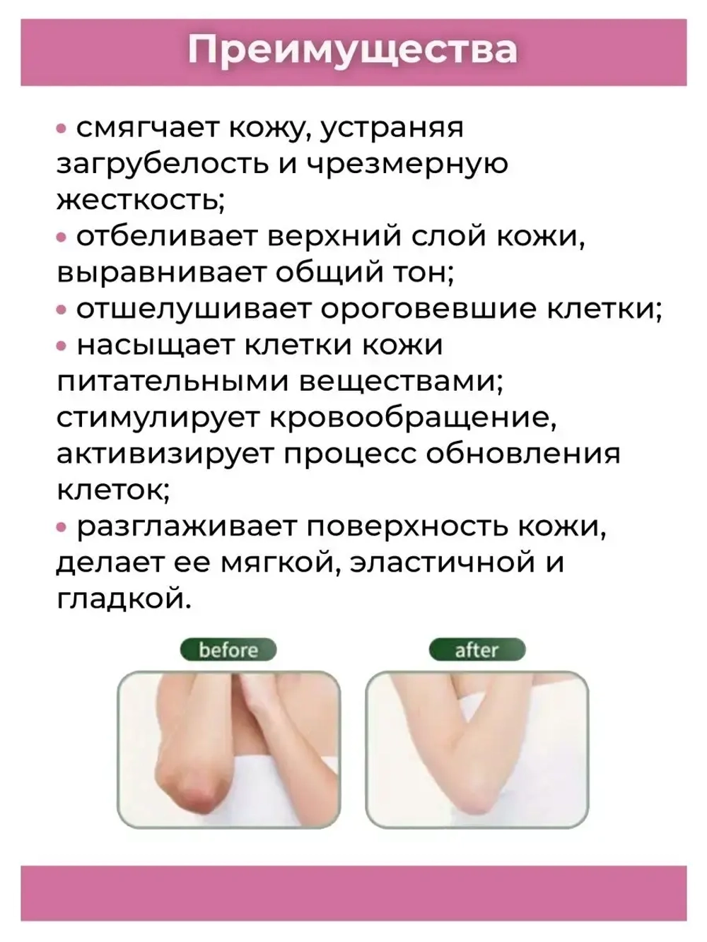 Тайский осветляющий крем для локтей.