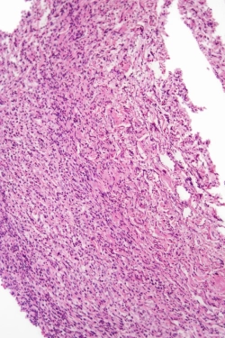 Изготовление гистологических препаратов