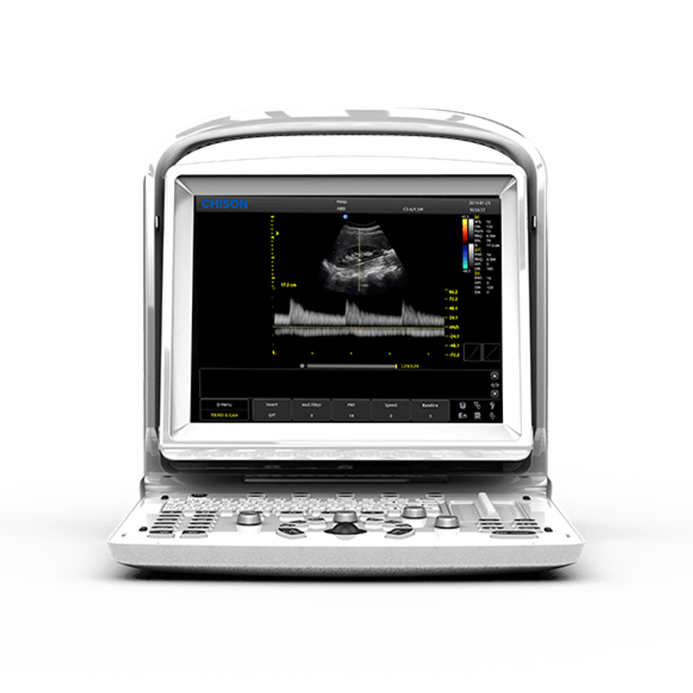 УЗИ аппарат CHISON ECO 3 Expert