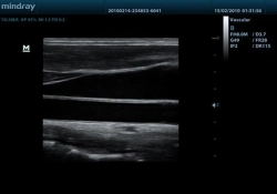 Аппарат УЗИ (сканер) Mindray DP-50