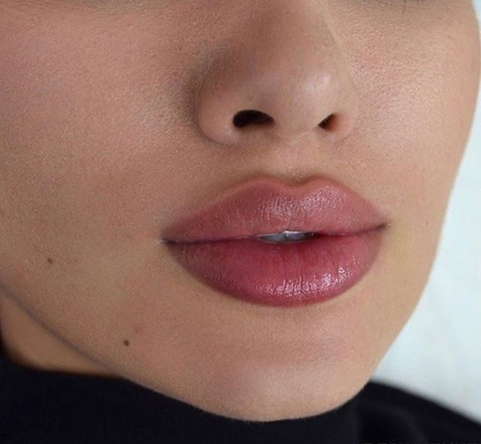 Контурная пластика губ