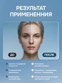 Сыворотка для лица увлажняющая с микроиглами и гиалуроном