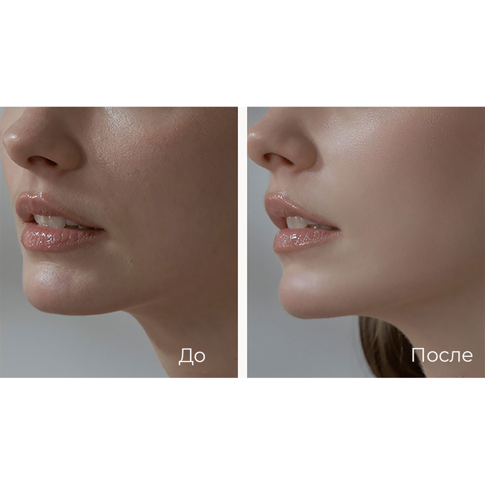 Phymongshe Сменный блок (рефил) BB крем-кушона Aqua Blemish Cover Balm Cushon 15 мл