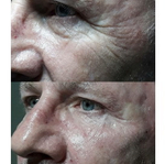 PDRN Rejuvenating Ampoule Eldermafill | Мощная регенерация