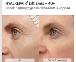 Hyalrepair Lift Eyes | ГК 12 мг/мл + Вит.С и Аминокислоты