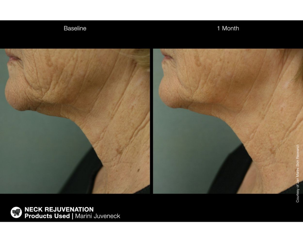 JAN MARINI JUVENECK NECK CREAM Омолаживающий лифтинг-крем против дряблости кожи шеи и декольте