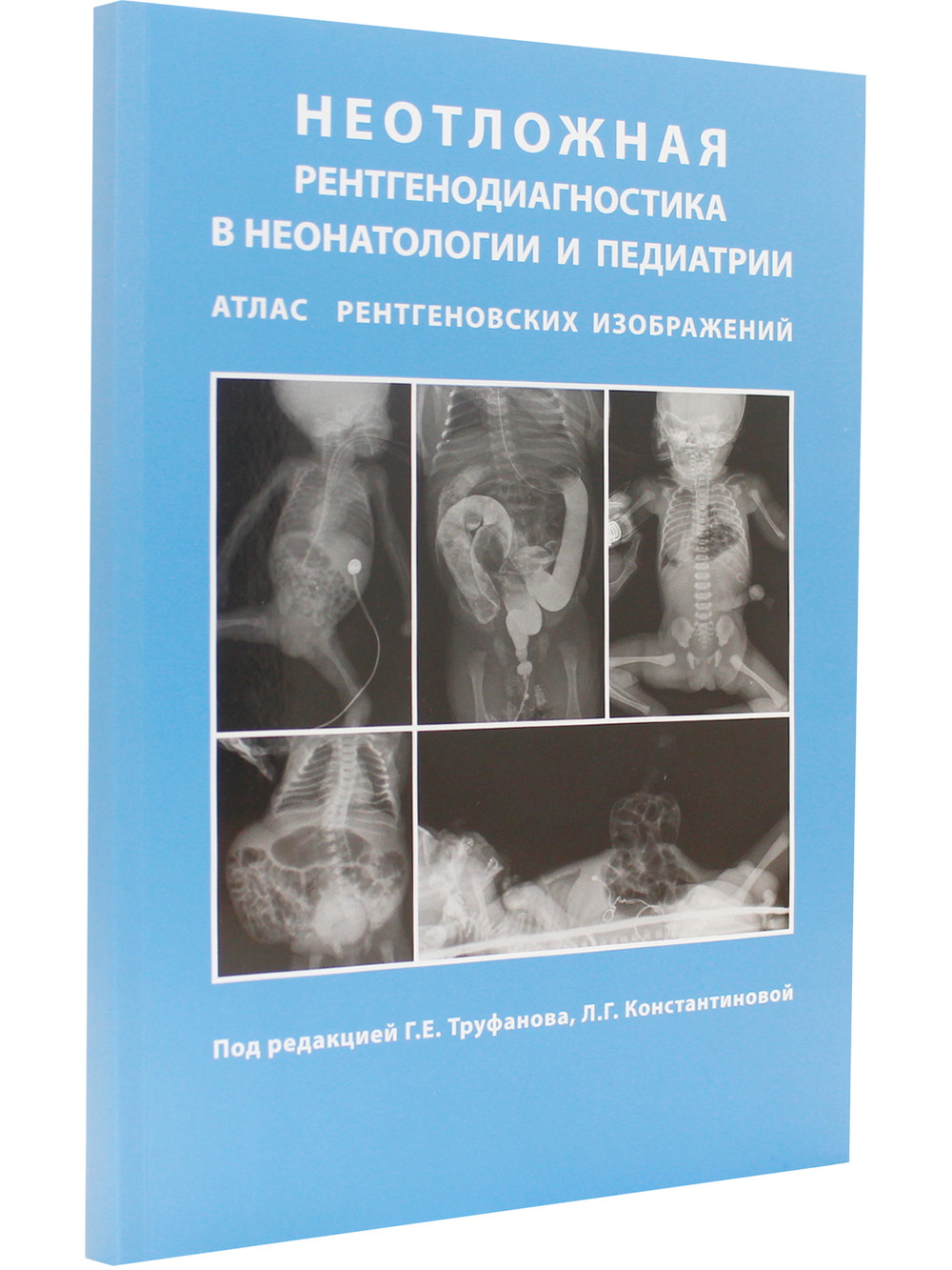 Неотложная рентгенодиагностика в неонатологии и педиатрии (Атлас рентгеновских изображений). Руководство для врачей