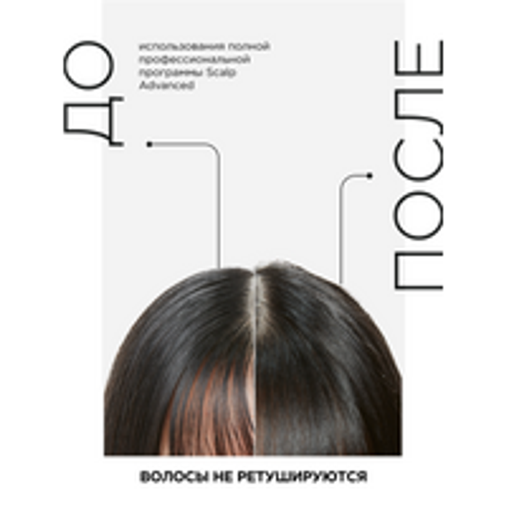 L'Oreal Professionnel Scalp Advanced шампунь регулирующий баланс чувствительной кожи головы, 300 мл.